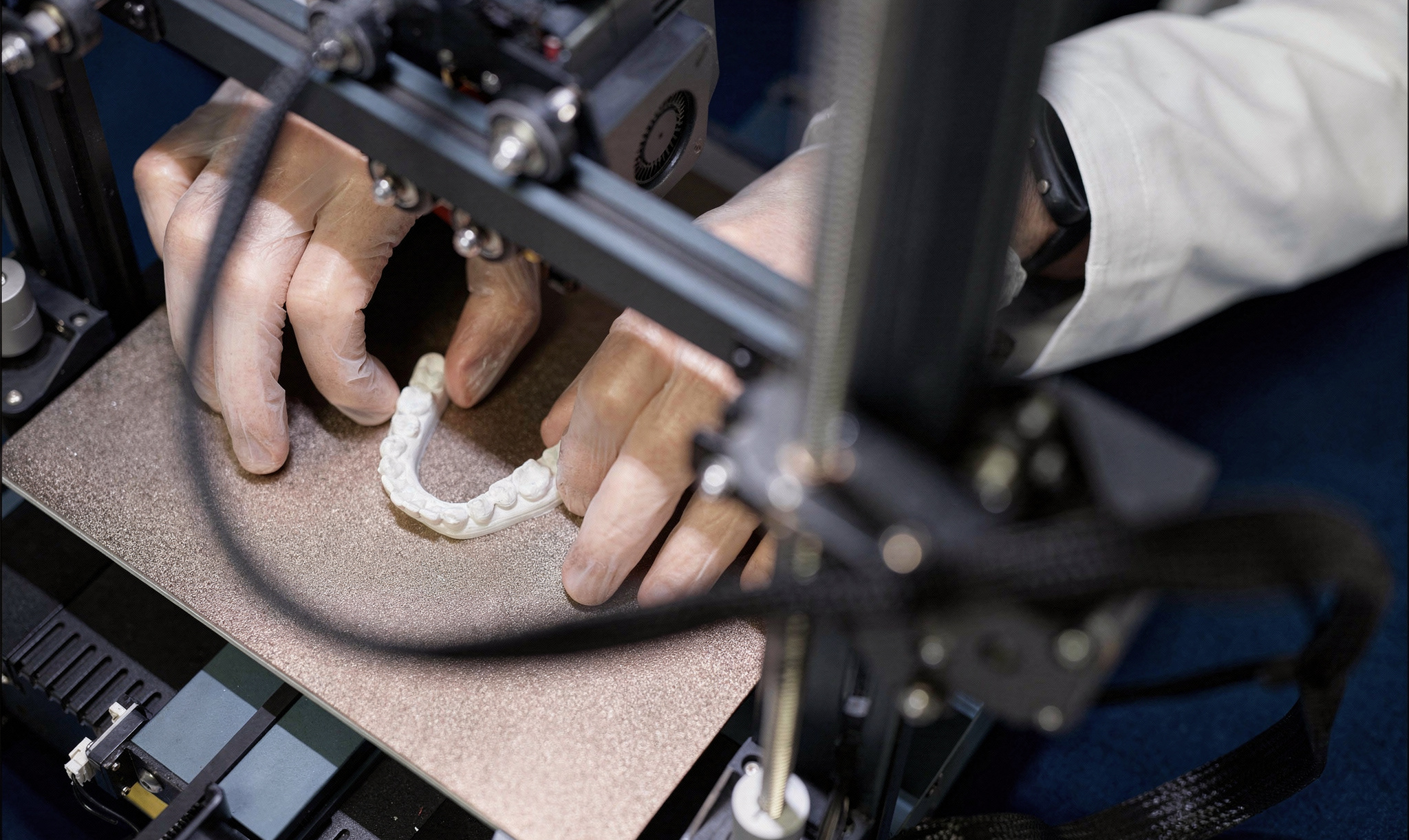 Why 3D printing is the future of patient-specific prosthetics and implants?